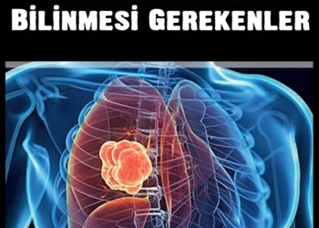 Akciğer Kanserinin Sinsi Belirtileri Bilinmesi Gerekenler 2