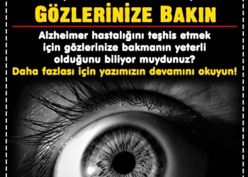 Alzheimer Hastalığını Teşhis Etmek İçin Gözlerinize Bakın 3