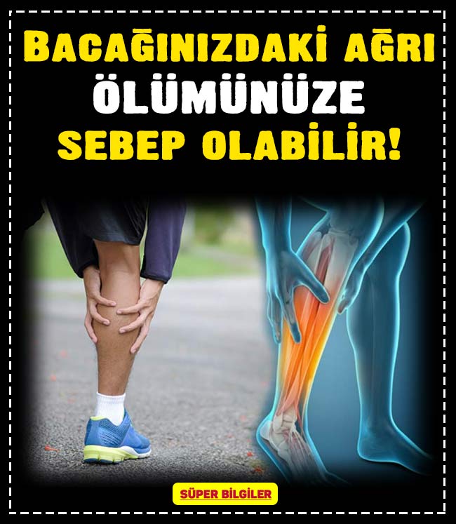 Bacağınızdaki ağrı ölümünüze sebep olabilir! 3