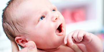 bebeklerde goz alti morlugu tedavisi f3xktse1.jpg