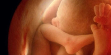 ultrasonda bebegin cinsiyetini gostermemesi kiz ve erkek bebek ultrasonda nasil gorunur dgczzrep.jpg