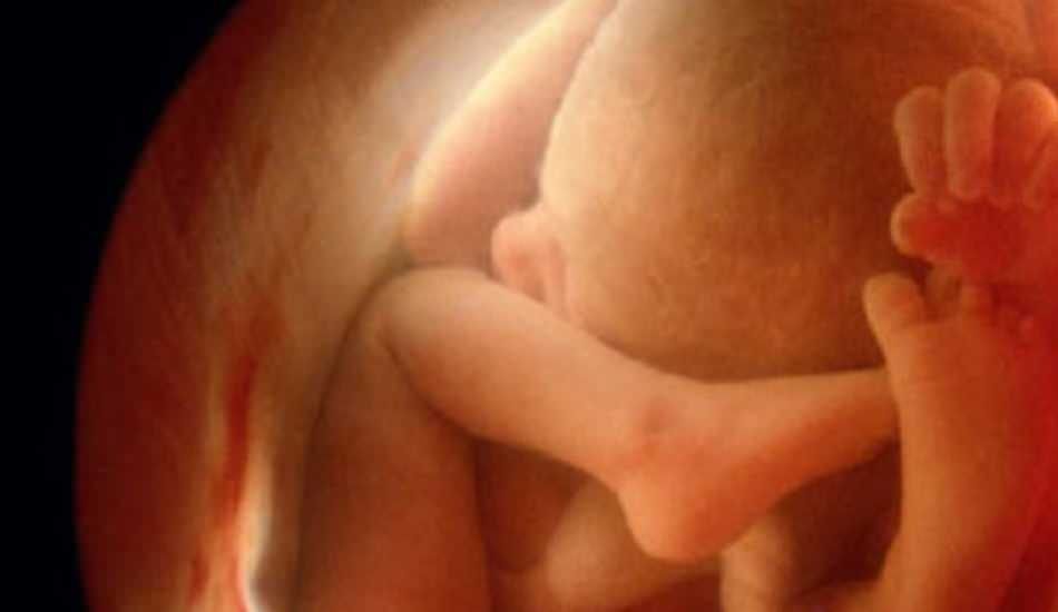 Ultrasonda bebeğin cinsiyetini göstermemesi! Kız ve erkek bebek ultrasonda nasıl görünür? 1